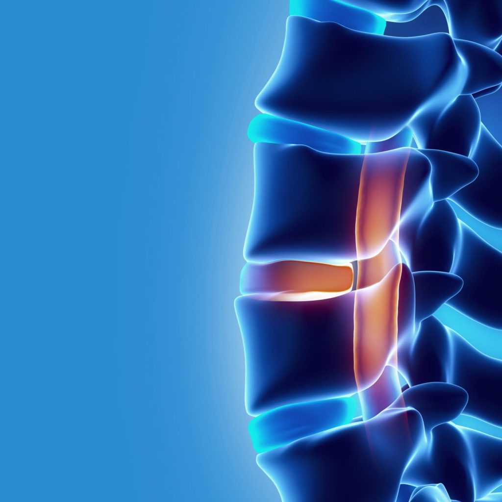 Treatments For Spinal Cord Injury & Neurological Conditions