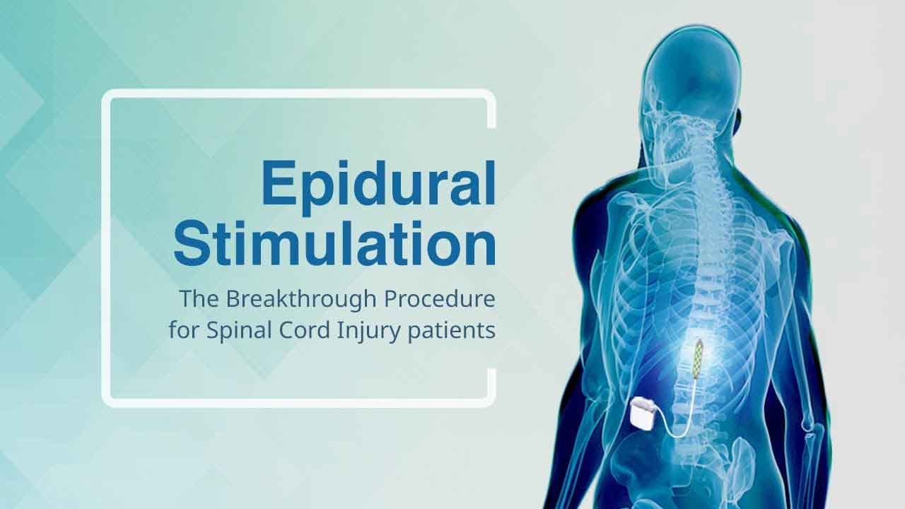 Epidural Stimulation: The Breakthrough Procedure for Spinal Cord Injury patients